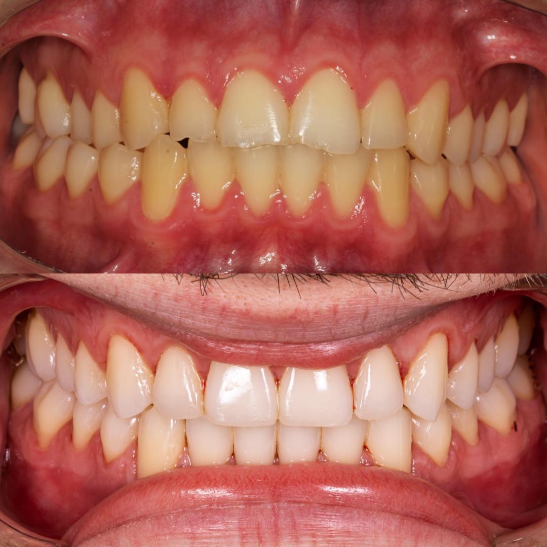 Paciente sorrindo em ambiente odontológico moderno e acolhedor — OdontoCentro Botucatu