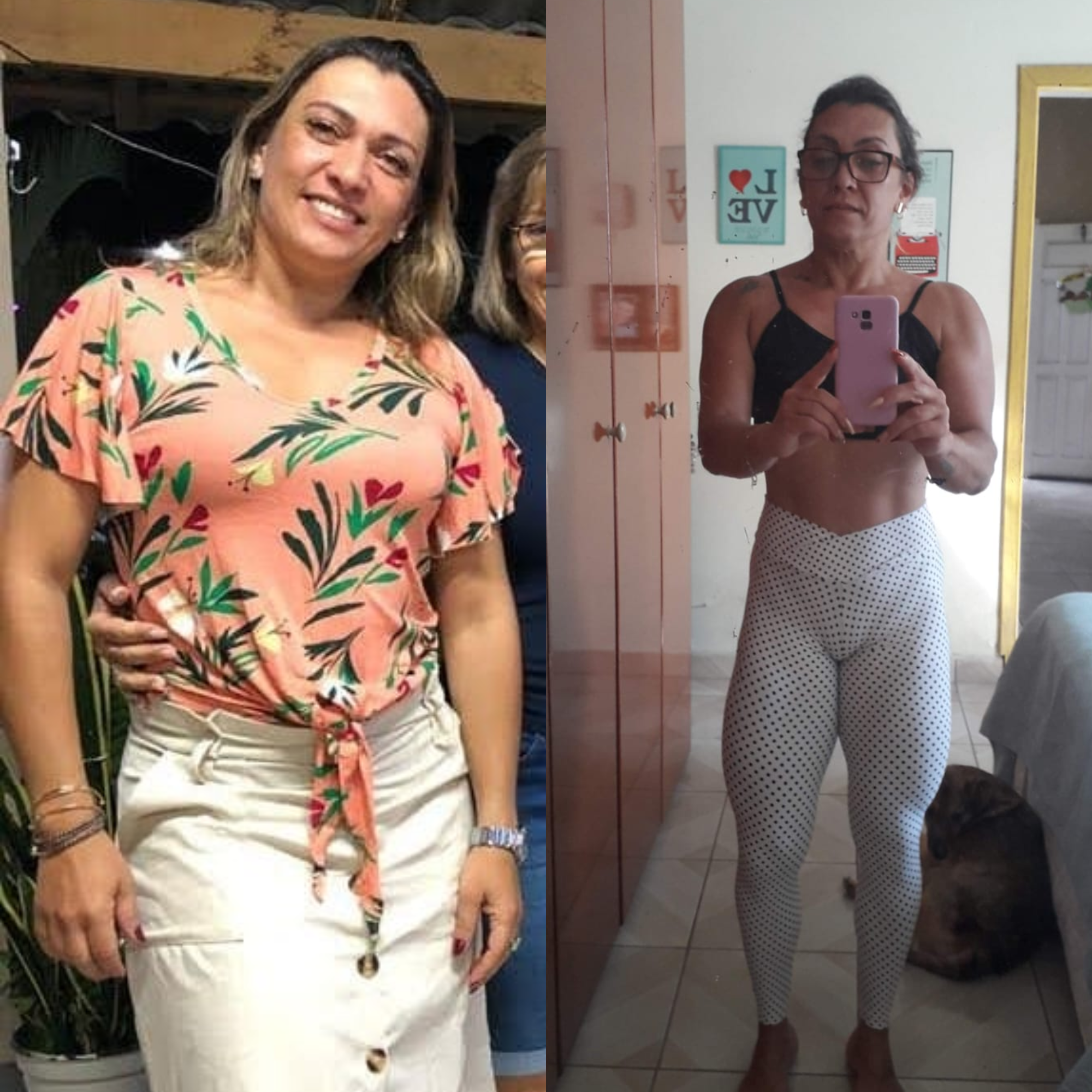 Transformação pós bariátrica